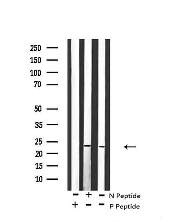 Phospho-BIM (Ser59) Antibody in Western Blot (WB)