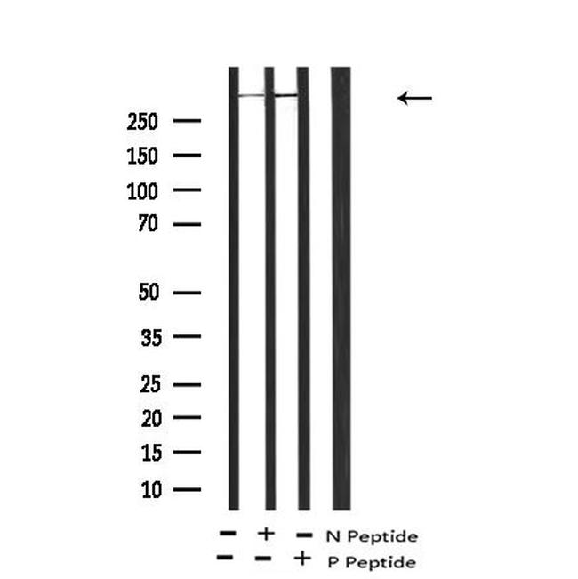 Phospho-LRP1 (Ser4520) Antibody in Western Blot (WB)