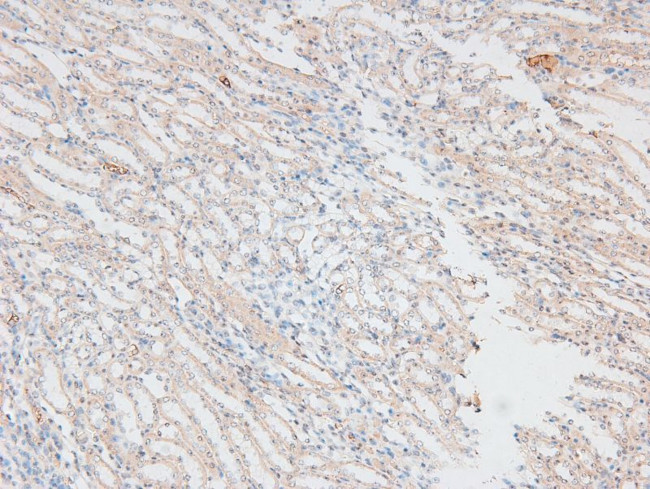 Phospho-CD45 (Tyr1218) Antibody in Immunohistochemistry (Paraffin) (IHC (P))