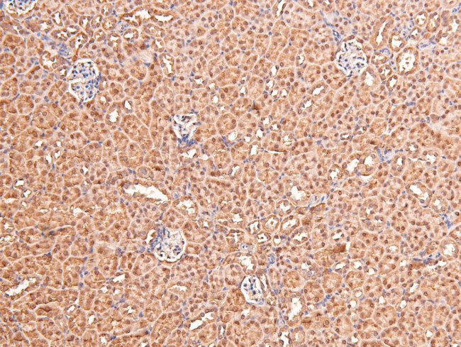 Phospho-FGFR1/FGFR2 (Tyr730, Tyr733) Antibody in Immunohistochemistry (Paraffin) (IHC (P))