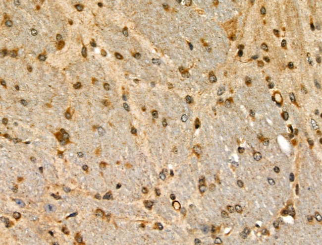 Phospho-SHC (Ser36) Antibody in Immunohistochemistry (Paraffin) (IHC (P))