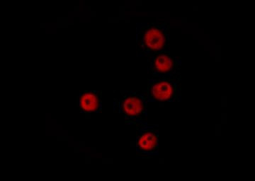 Phospho-53BP1 (Ser29) Antibody in Immunocytochemistry (ICC/IF)