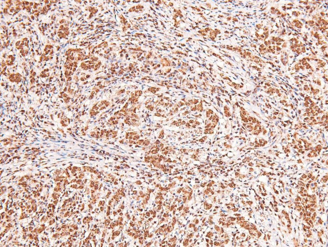 Phospho-Acinus (Ser1180) Antibody in Immunohistochemistry (Paraffin) (IHC (P))