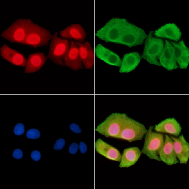 Phospho-AMPK beta-1 (Ser108) Antibody in Immunocytochemistry (ICC/IF)