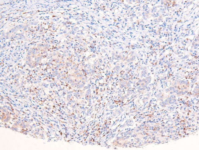 Phospho-ANKRD28 (Ser1007) Antibody in Immunohistochemistry (Paraffin) (IHC (P))