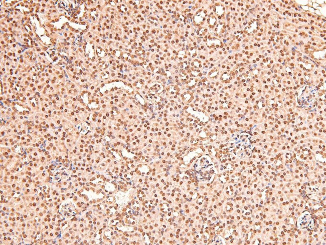 Phospho-BAG3 (Tyr457) Antibody in Immunohistochemistry (Paraffin) (IHC (P))