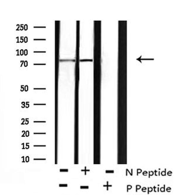 Phospho-BCL6 (Ser343) Antibody in Western Blot (WB)