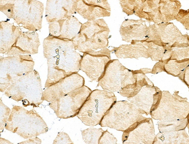 Phospho-Caldesmon (Ser759) Antibody in Immunohistochemistry (Paraffin) (IHC (P))