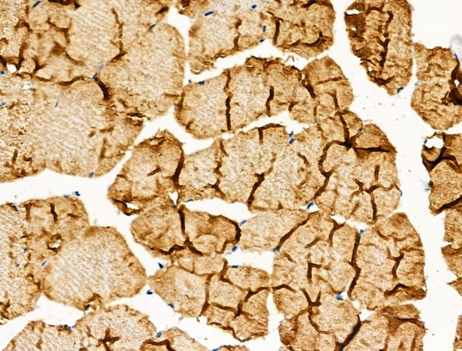 Phospho-Calpain 2 (Ser50) Antibody in Immunohistochemistry (Paraffin) (IHC (P))