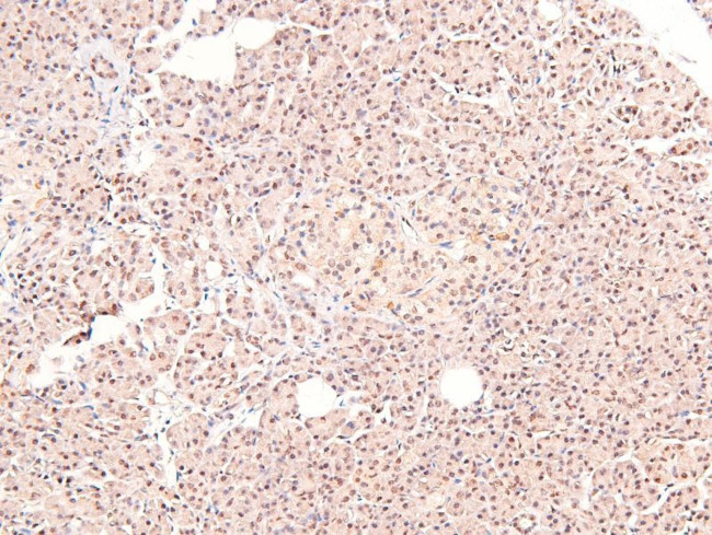 Phospho-ARHGAP31 (Thr789) Antibody in Immunohistochemistry (Paraffin) (IHC (P))