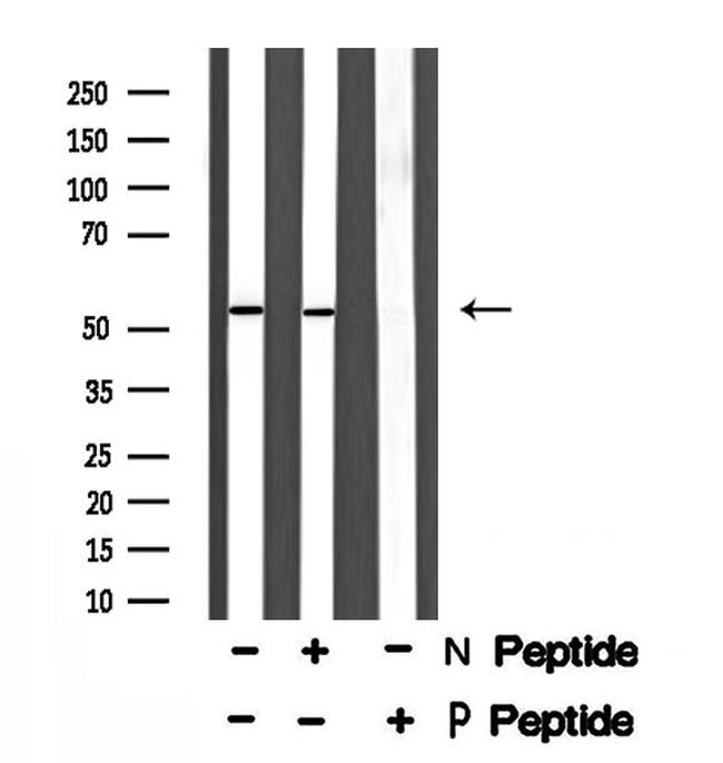 Phospho-CEP55 (Ser425) Antibody in Western Blot (WB)