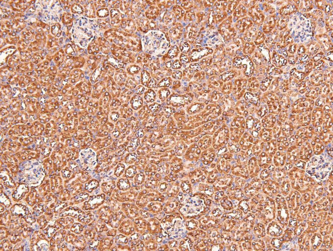 Phospho-Claudin 1 (Tyr210) Antibody in Immunohistochemistry (Paraffin) (IHC (P))