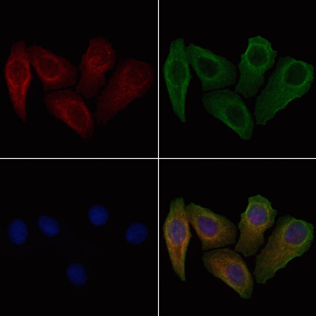Phospho-Cyclin B1 (Ser133) Antibody in Immunocytochemistry (ICC/IF)