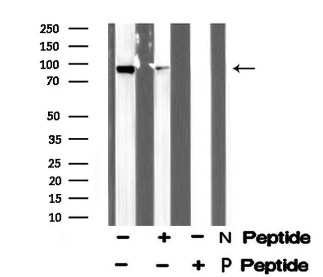 Phospho-FOXO3A (Ser321) Antibody in Western Blot (WB)