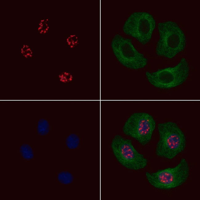 Phospho-JDP2 (Thr148) Antibody in Immunocytochemistry (ICC/IF)