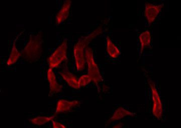 Phospho-LIMK1 (Ser310) Antibody in Immunocytochemistry (ICC/IF)