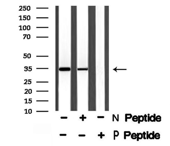 Phospho-MCL-1 (Thr163) Antibody in Western Blot (WB)