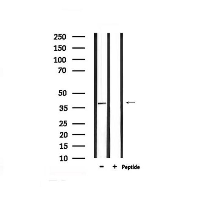 Phospho-NDRG2 (Thr348) Antibody in Western Blot (WB)