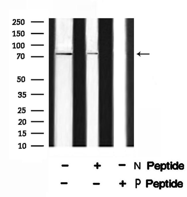 Phospho-p73 (Thr86) Antibody in Western Blot (WB)