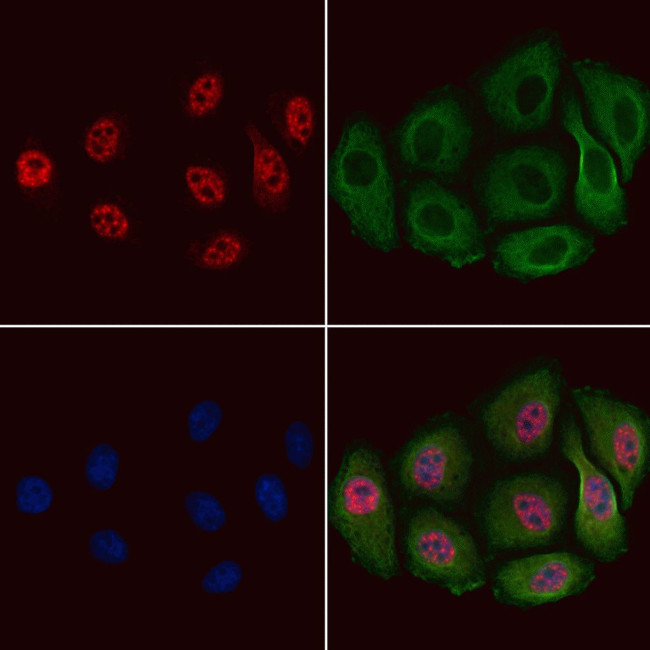 Phospho-PDX1 (Ser66) Antibody in Immunocytochemistry (ICC/IF)