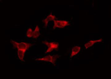 Phospho-Progesterone Receptor (Ser345) Antibody in Immunocytochemistry (ICC/IF)