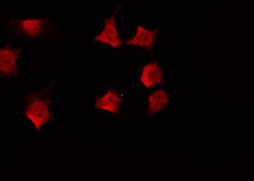 Phospho-Presenilin 1 (Ser353) Antibody in Immunocytochemistry (ICC/IF)