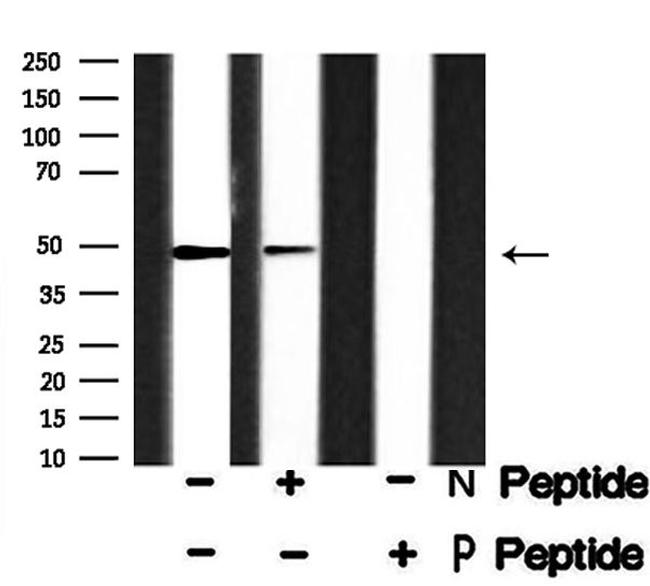 Phospho-RAD23A (Ser357) Antibody in Western Blot (WB)