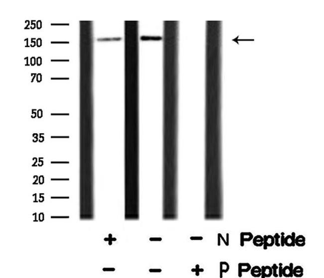 Phospho-RAD50 (Ser635) Antibody in Western Blot (WB)