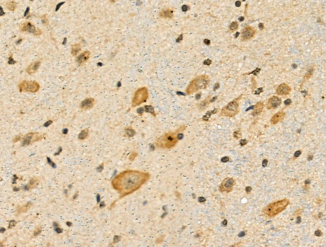 Phospho-S6 (Ser244) Antibody in Immunohistochemistry (Paraffin) (IHC (P))
