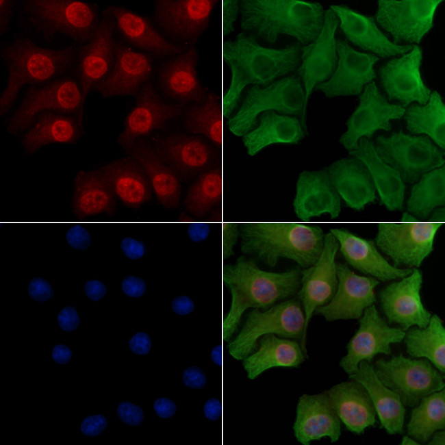 Phospho-SMAD4 (Thr277) Antibody in Immunocytochemistry (ICC/IF)