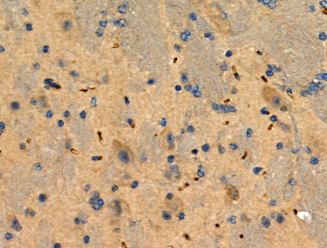 Phospho-STMN2 (Ser73) Antibody in Immunohistochemistry (Paraffin) (IHC (P))