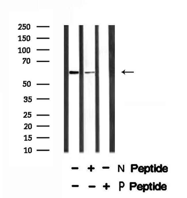 Phospho-TAB1 (Ser438) Antibody in Western Blot (WB)