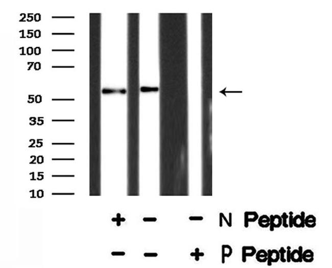 Phospho-ETV6 (Ser257) Antibody in Western Blot (WB)