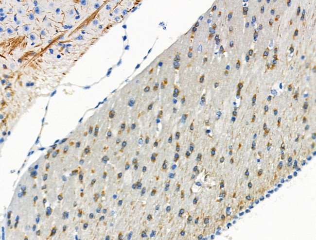 Phospho-Torc2 (Ser171) Antibody in Immunohistochemistry (Paraffin) (IHC (P))