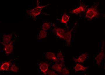 Phospho-TSC2 (Ser981) Antibody in Immunocytochemistry (ICC/IF)