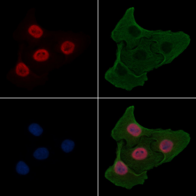 Phospho-USP28 (Ser714) Antibody in Immunocytochemistry (ICC/IF)