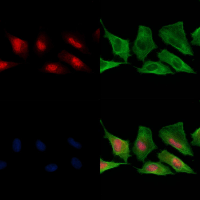 Phospho-VHL (Ser68) Antibody in Immunocytochemistry (ICC/IF)