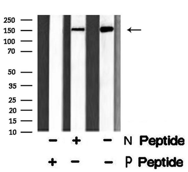 Phospho-ALK (Tyr1586) Antibody in Western Blot (WB)