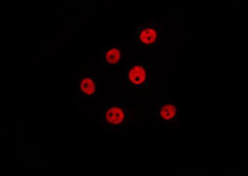Phospho-Cyclin E (Ser399) Antibody in Immunocytochemistry (ICC/IF)