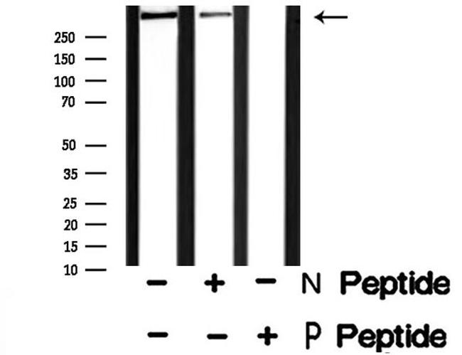 Phospho-IP3 Receptor 1 (Tyr353) Antibody in Western Blot (WB)