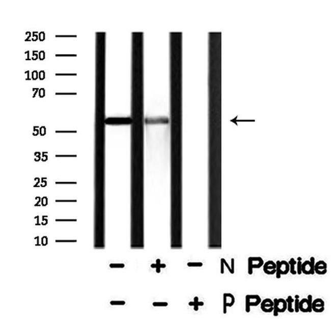 Phospho-DOK2 (Tyr345) Antibody in Western Blot (WB)