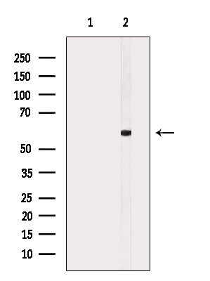 Phospho-AKT1 (Ser473, Tyr474) Antibody in Western Blot (WB)