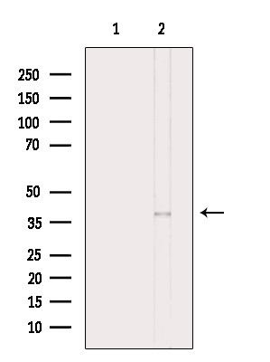 Phospho-C5AR1 (Ser334) Antibody in Western Blot (WB)