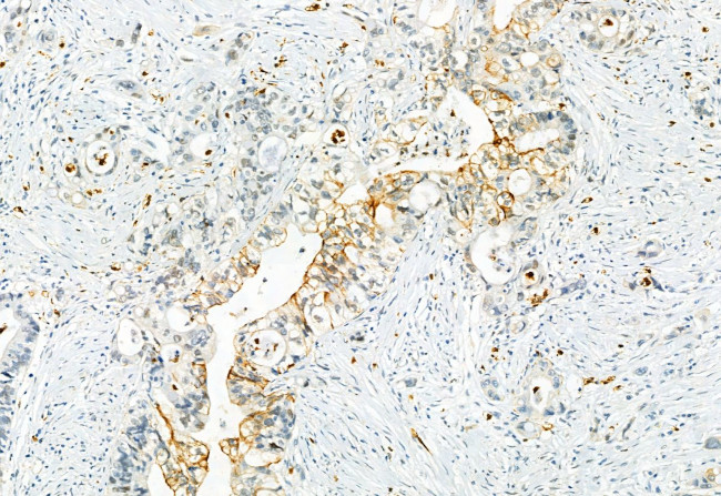 Phospho-CaV1.2 (Ser1981) Antibody in Immunohistochemistry (Paraffin) (IHC (P))