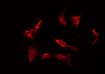 Phospho-Caspase 3 (Ser26) Antibody in Immunocytochemistry (ICC/IF)