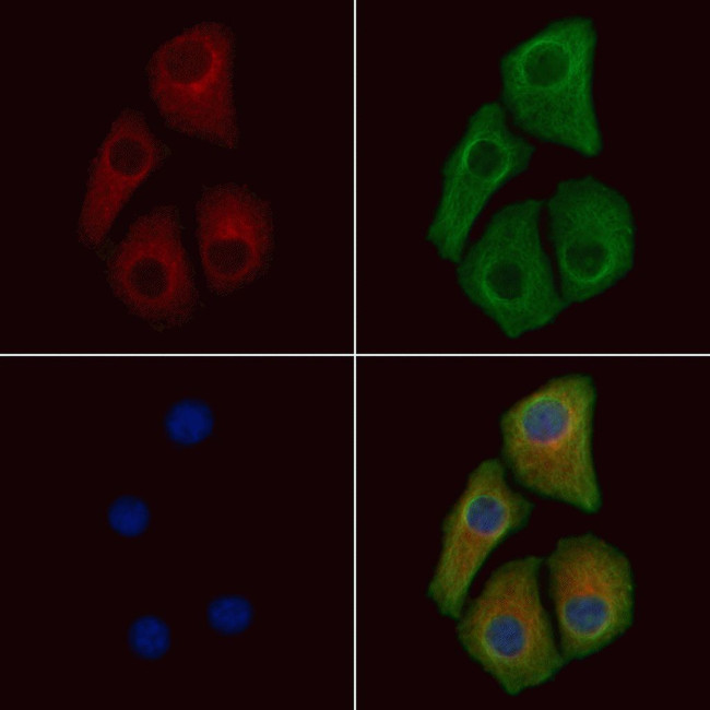Phospho-CDK5 (Ser159) Antibody in Immunocytochemistry (ICC/IF)
