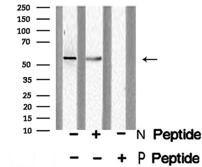 Phospho-DOK2 (Tyr139) Antibody in Western Blot (WB)
