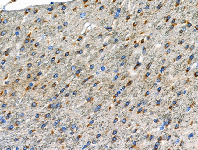 Phospho-GABBR2 (Ser893) Antibody in Immunohistochemistry (Paraffin) (IHC (P))