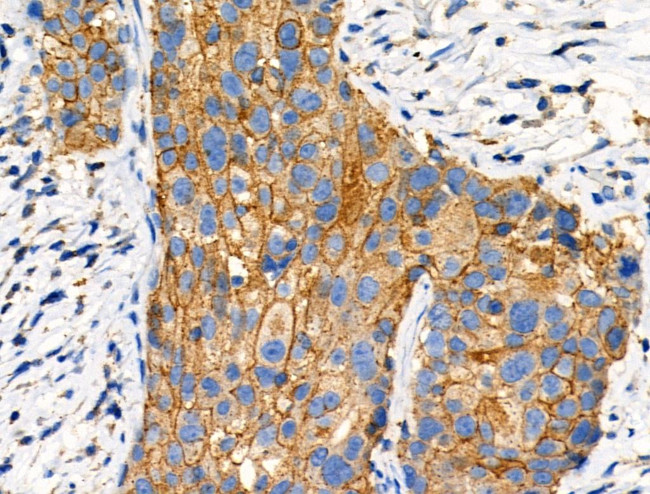 Phospho-GRK2 (Tyr86) Antibody in Immunohistochemistry (Paraffin) (IHC (P))