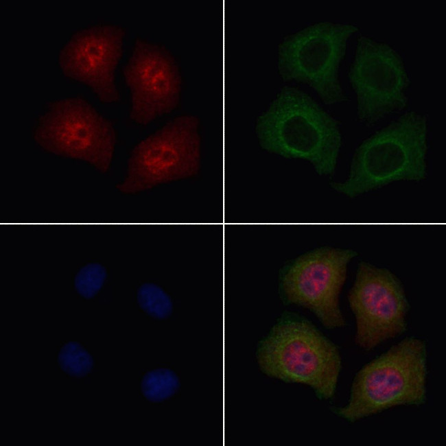 Phospho-HDAC7 (Ser486) Antibody in Immunocytochemistry (ICC/IF)